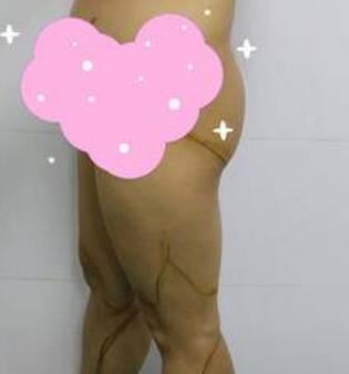 叶飞