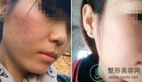 罗莉