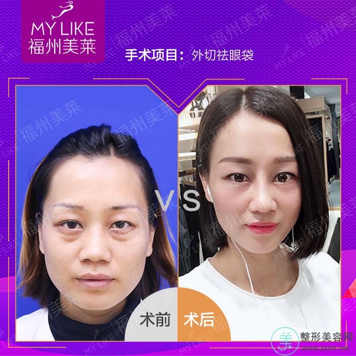 吴正思