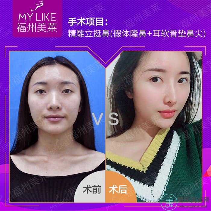 彭延丽