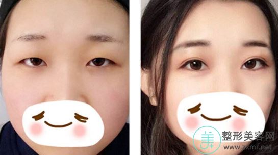 彭延丽