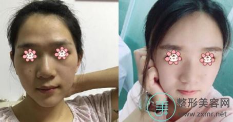 周珃