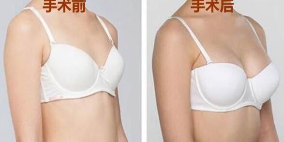 邹燕林