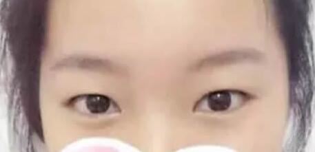 邹燕林