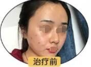 王黎