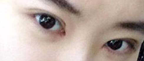 郄美芳