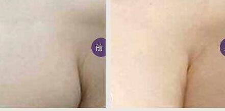 肖曙光