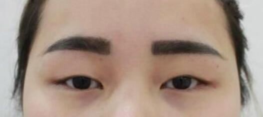 李丽杰