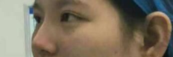 李丽杰