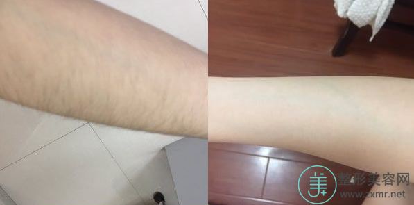 李莺