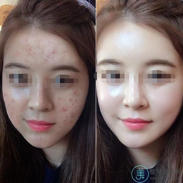 李莺