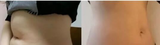 刘静杰