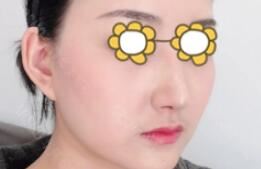 沈丽