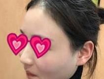 雷少榕
