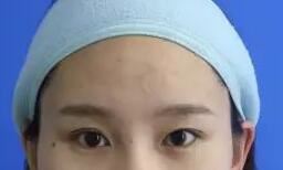 杨艳艳