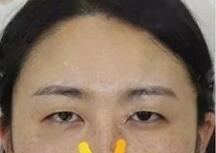 汤芳芳