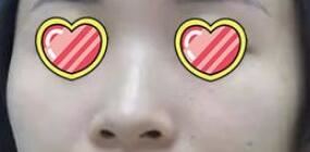 熊丽