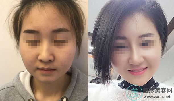 刘强