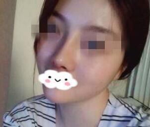 郭莉