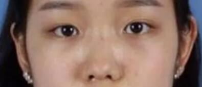 朱飞