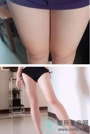 温亮