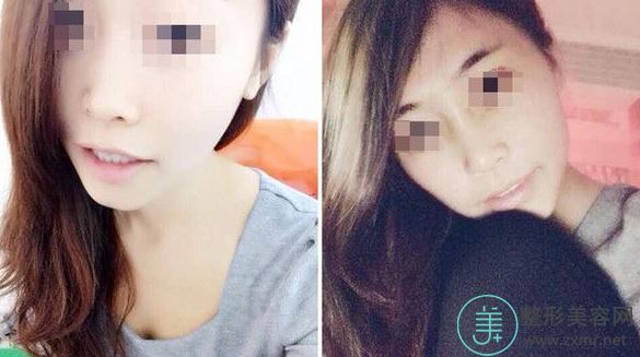 梁志伟