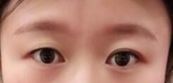 董红星