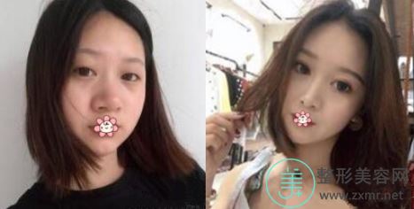 李勇强