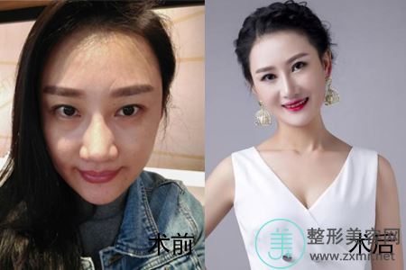 李俊
