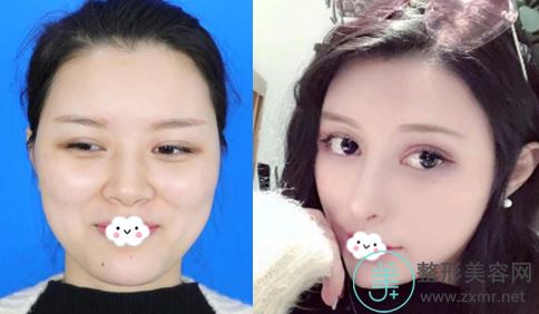 贾治兰