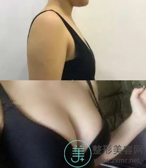 郝劲伟