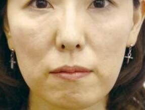 张国辉