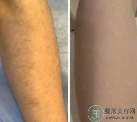 张栋