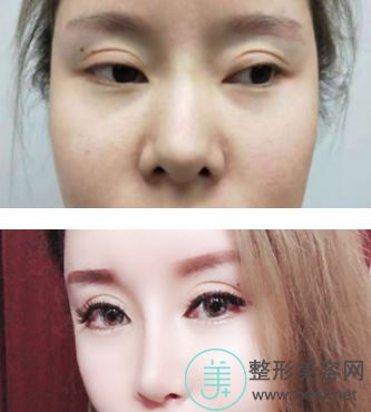 张栋