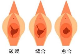 王秀杰