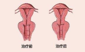 王秀杰