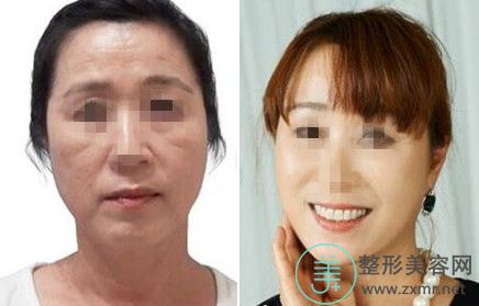 谢洪英
