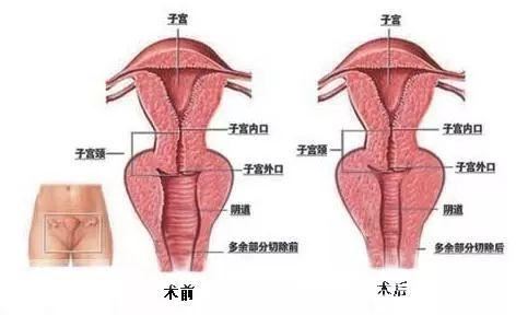 赵秀玲
