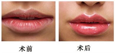 陈洁