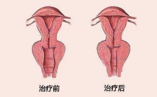 王冰
