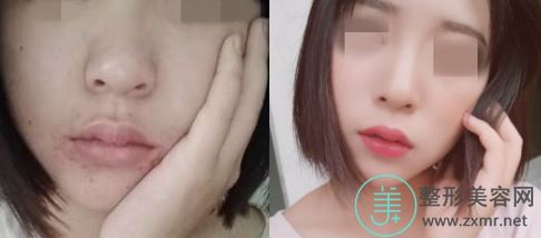 王安