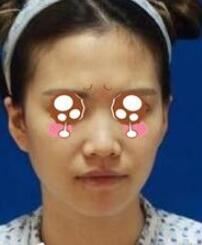 明慧