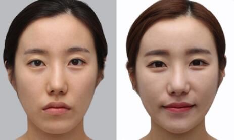 杨建