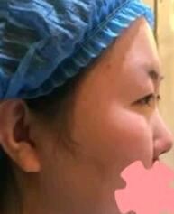 刘莎莎