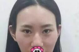 黄凯