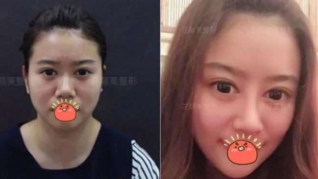徐斌