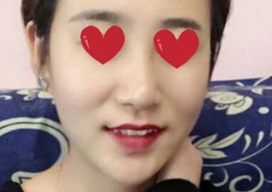 张丽华