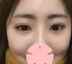 于红梅