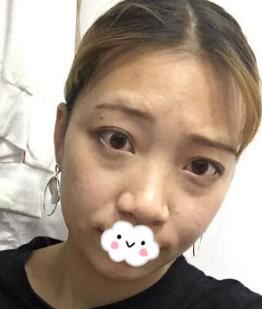 王侠
