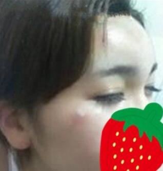 杨璐